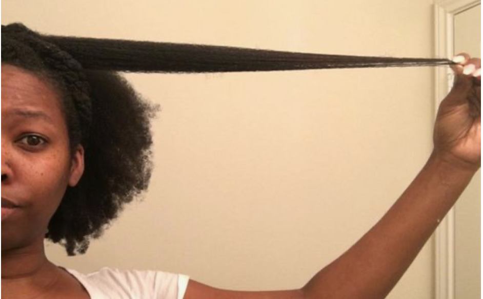 France en vitamine D 
Carence cheveux crépus 